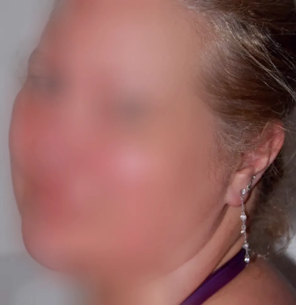 Aleyna, 28
